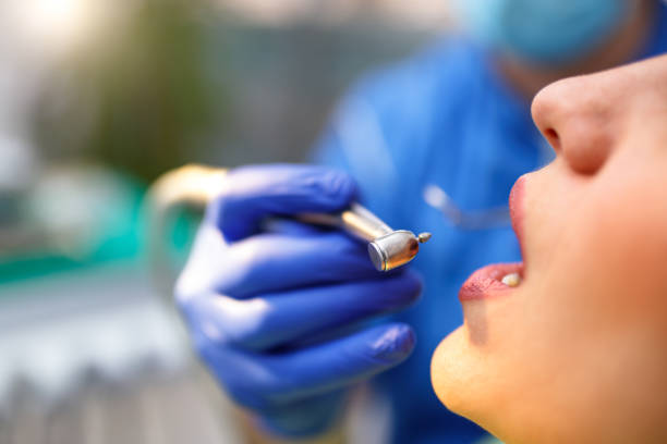 Best Veneers and Lumineers  in Stallion Springs, CA